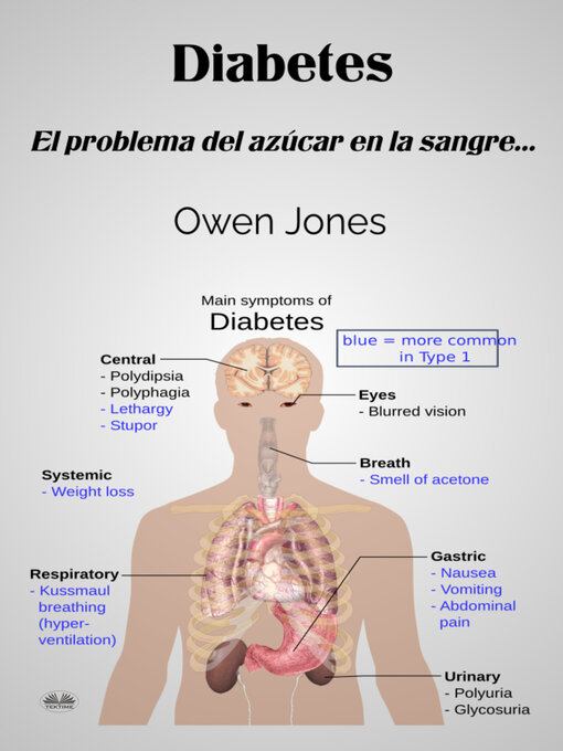 Title details for Diabetes by Owen Jones - Available